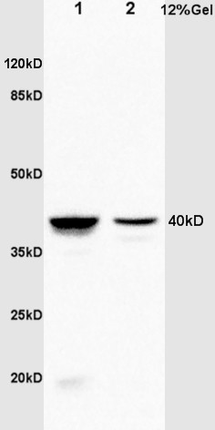 Annexin A1 Rabbit pAb(bs-1562R