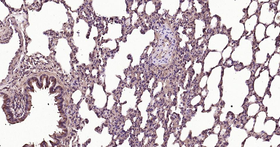 RAB5B Rabbit pAb(bs-11783R)-50