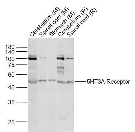 5HT3A Receptor Rabbit pAb(bs-1