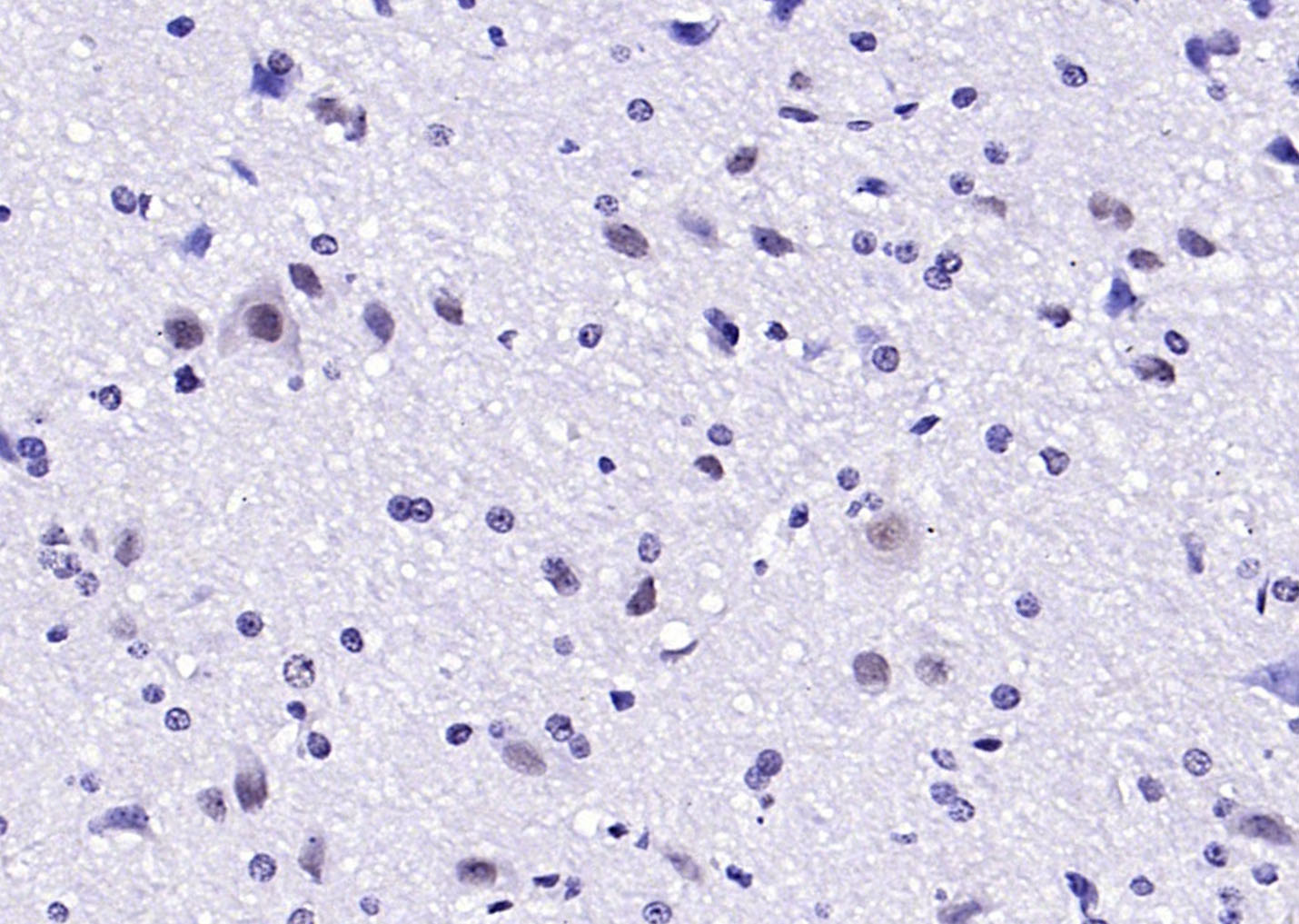 HOXA6 Rabbit pAb(bs-11294R)-50