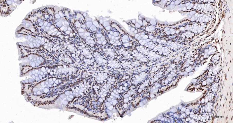 Histone H3(di methyl K27) Mous