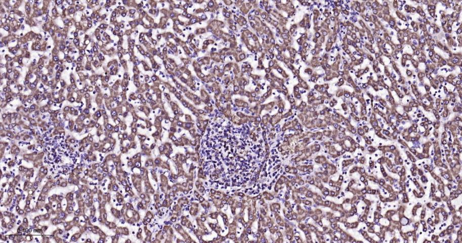 VDAC1 Recombinant Rabbit mAb, 