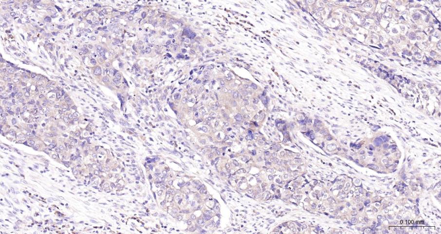 PI3 Kinase p110 beta Rabbit pA