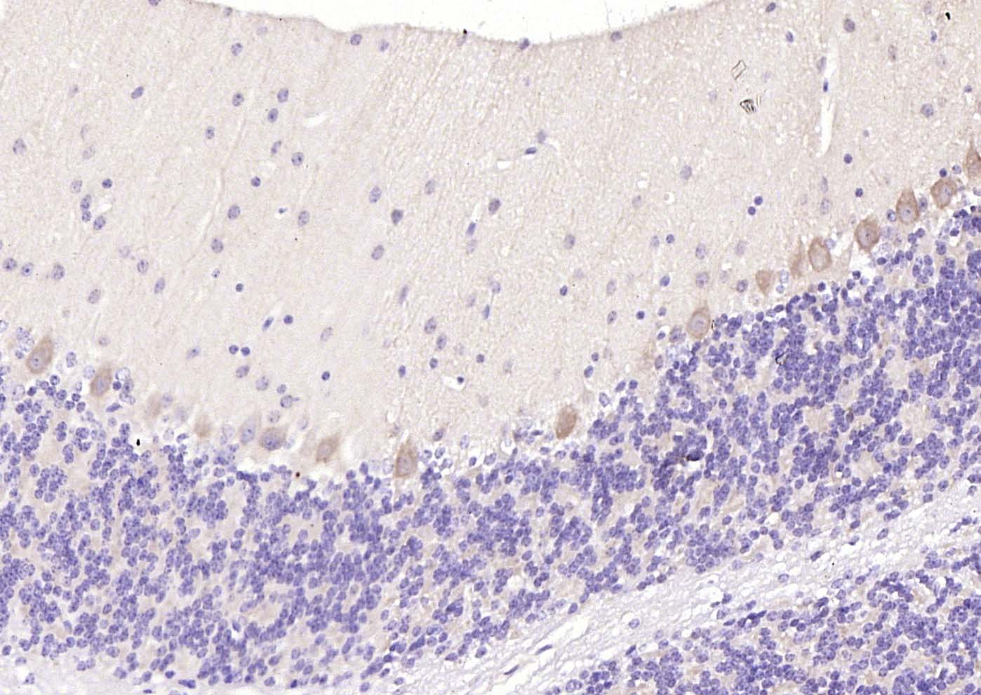 5HT7 Receptor Rabbit pAb(bs-12