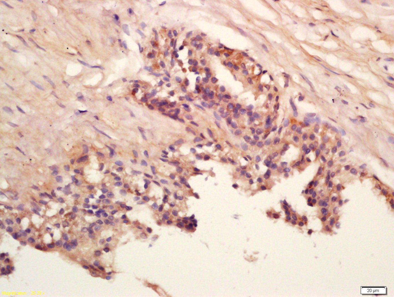 GCDFP15 Rabbit pAb(bs-10273R)-