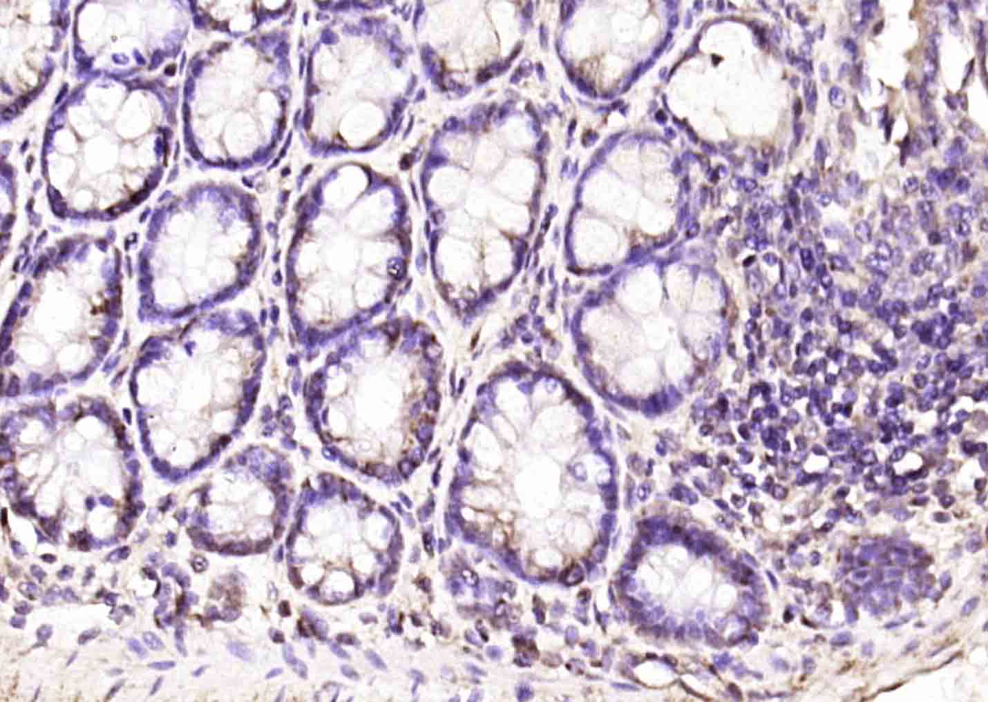 EAF2 Rabbit pAb(bs-7661R)-50ul