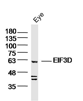 EIF3D Rabbit pAb(bs-14543R)-50