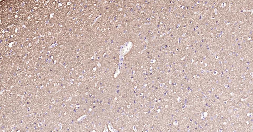 Alpha-Synuclein Mouse mAb(bsm-