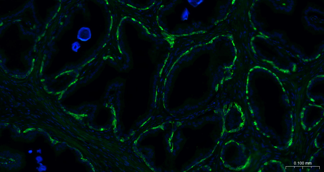 Cytokeratin 14 Recombinant Rab