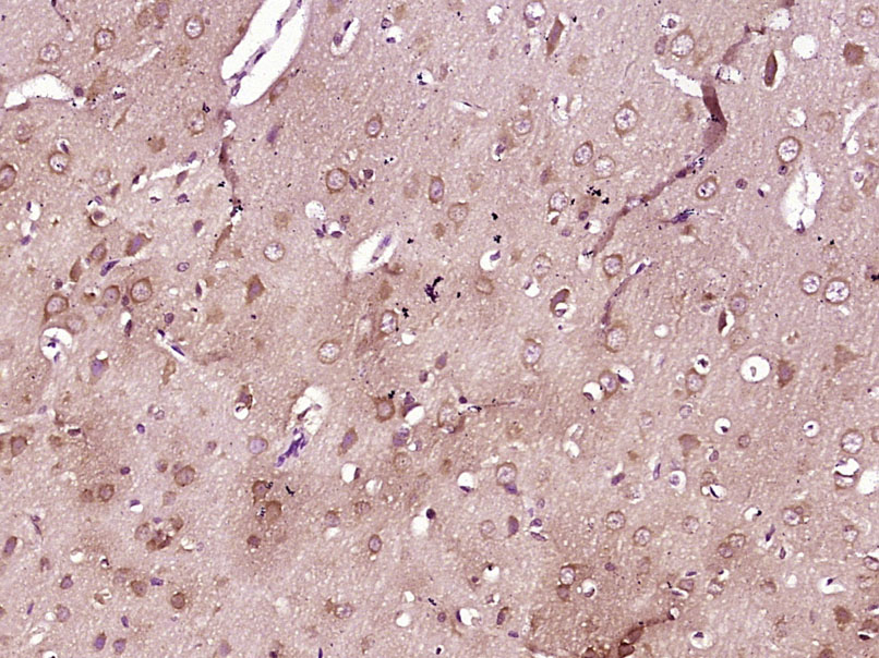 SLC36A2 Rabbit pAb(bs-21271R)-