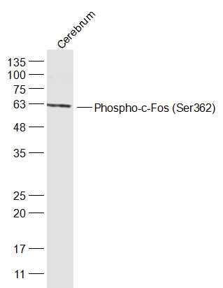 phospho-c-Fos (Ser362) Rabbit