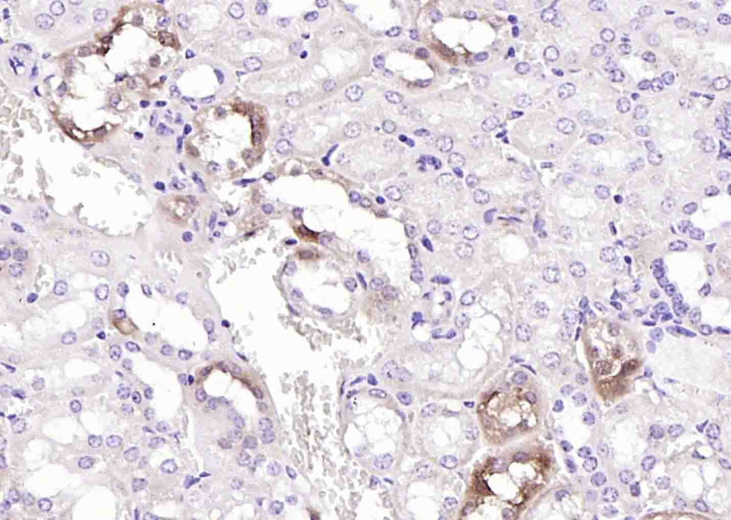 MGAT5 Rabbit pAb(bs-5841R)-50u