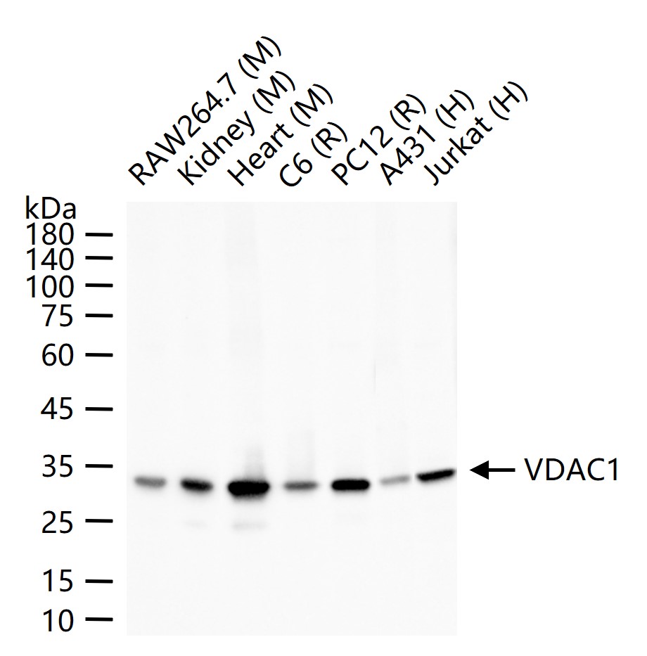 VDAC1 Recombinant Rabbit mAb, 