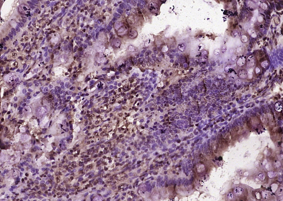 BTBD7 Rabbit pAb(bs-7979R)-50u