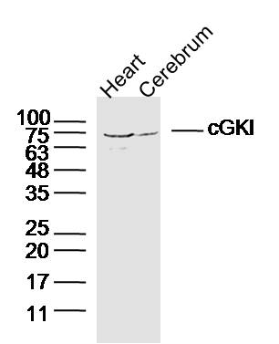 cGKI Rabbit pAb(bs-6705R)-50ul