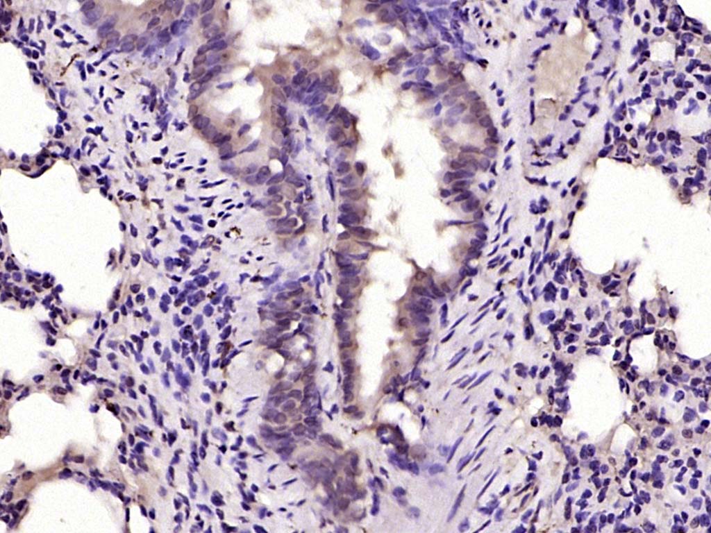 CHD3 Rabbit pAb(bs-8162R)-50ul