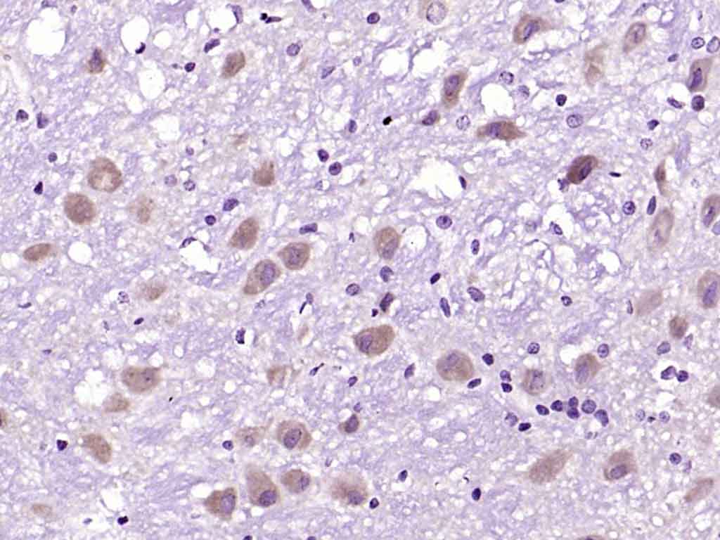 CAPRIN2 Rabbit pAb(bs-12423R)-