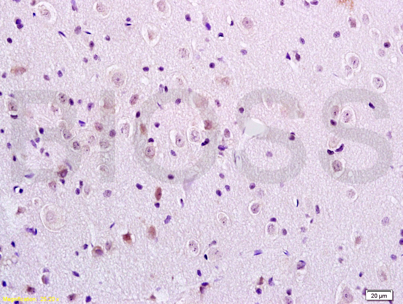 FREAC3 Rabbit pAb(bs-6642R)-50