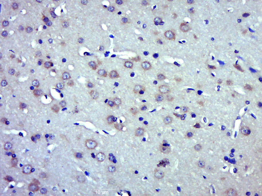 phospho-BACE1 (Ser498) Rabbit 