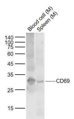 CD69 Rabbit pAb(bs-2499R)-50ul