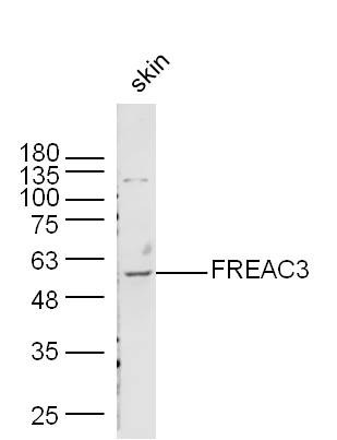 FREAC3 Rabbit pAb(bs-6642R)-50