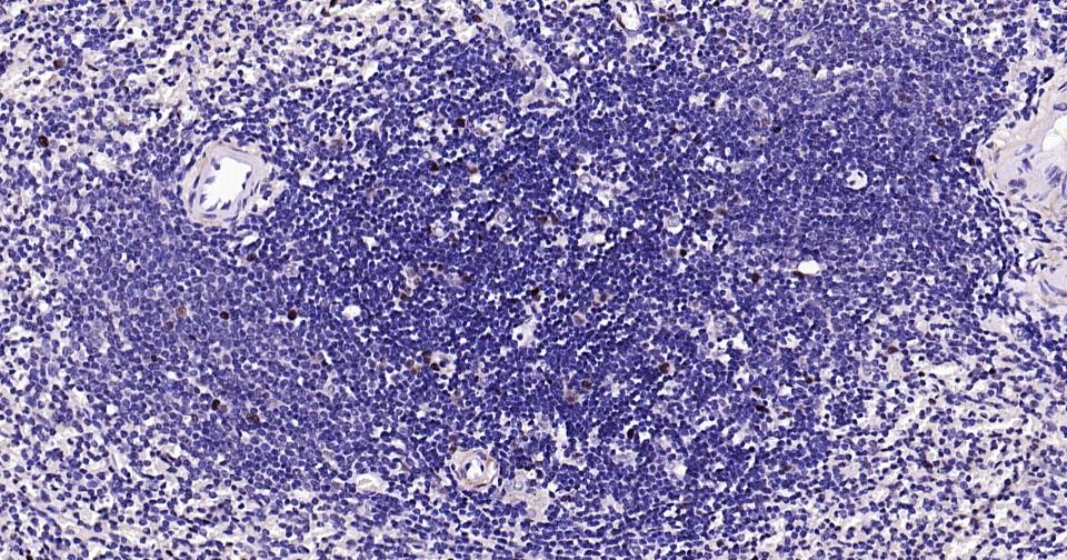 PCNA Rabbit pAb(bs-10889R)-50u