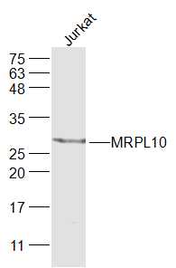 MRPL10 Rabbit pAb(bs-17768R)-5