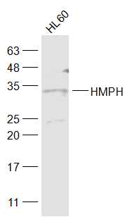 HMPH Rabbit pAb(bs-6600R)-50ul