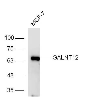 GALNT12 Rabbit pAb(bs-13272R)-