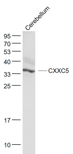 CXXC5 Rabbit pAb(bs-6890R)-50u
