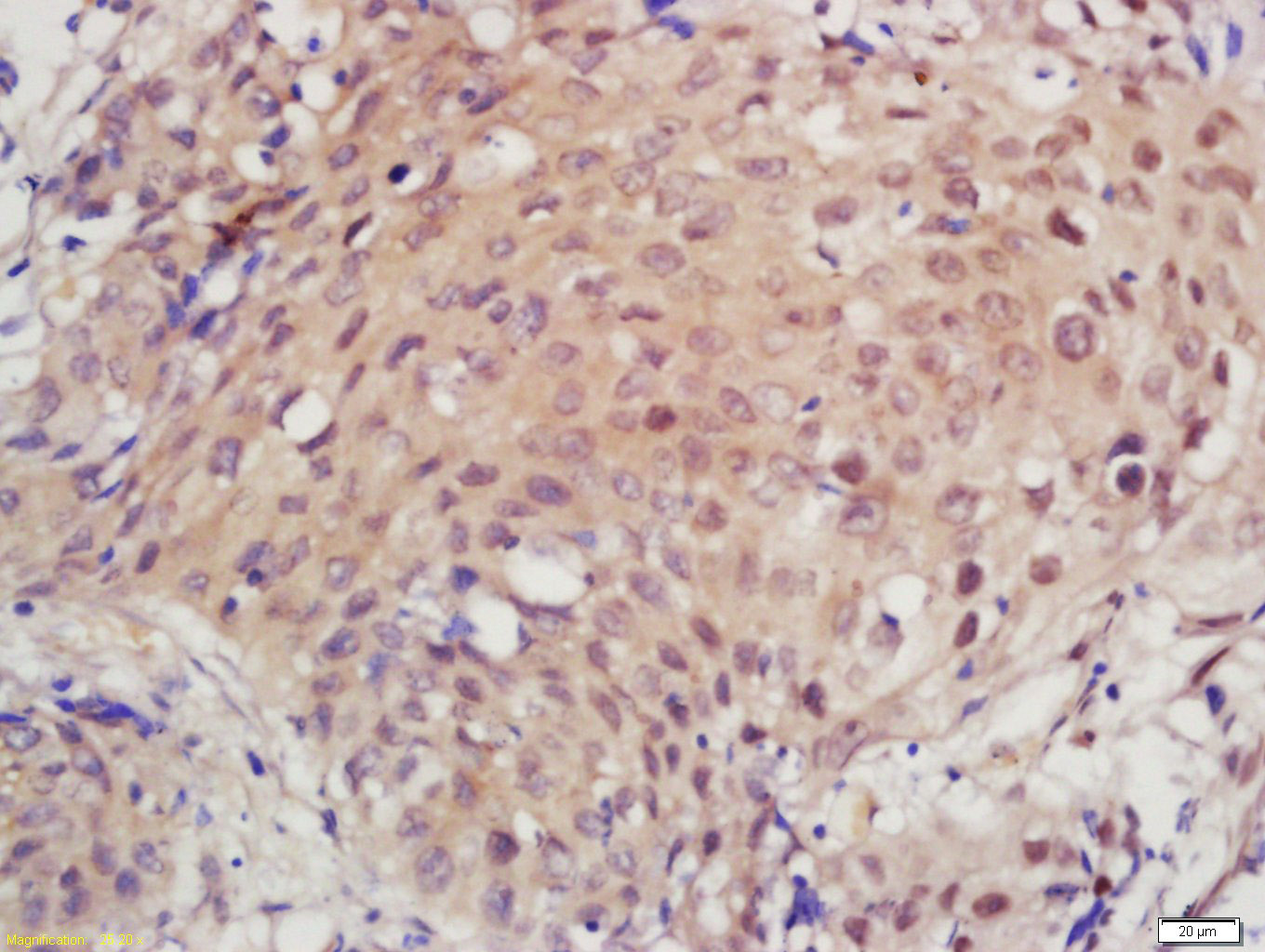 GTF2H2/TFIIH p44 Rabbit pAb(bs