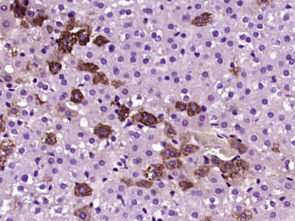 SLC47A1 Rabbit pAb(bs-9284R)-5