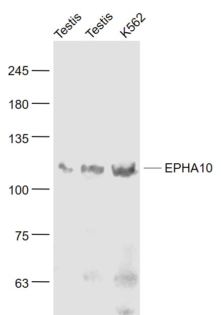 EPHA10 Rabbit pAb(bs-10052R)-5