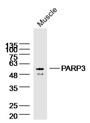 PARP3 Rabbit pAb(bs-7108R)-50u