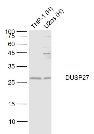 DUSP27 Rabbit pAb(bs-8711R)-50