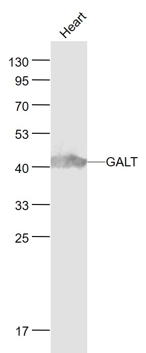 GALT Rabbit pAb(bs-3984R)-50ul