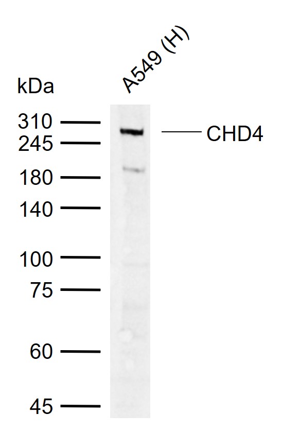 CHD4 Rabbit pAb(bs-13893R)-50u