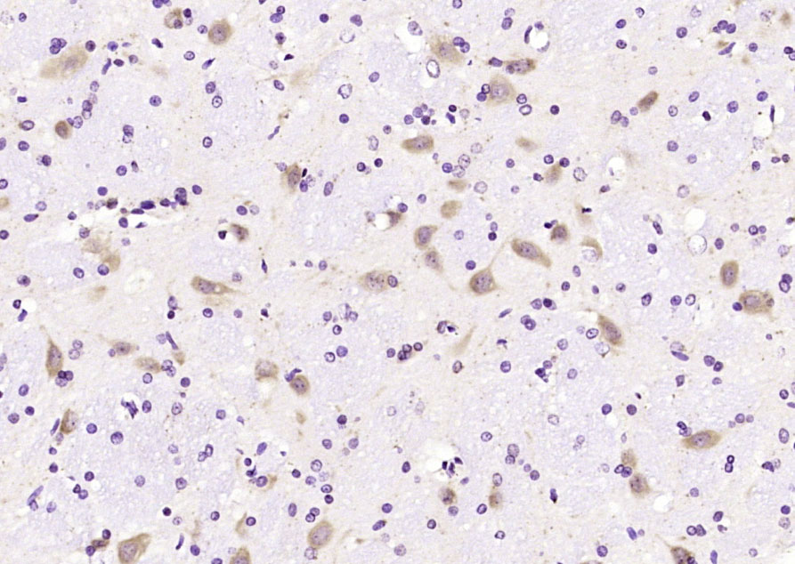 NALP12 Rabbit pAb(bs-6864R)-50