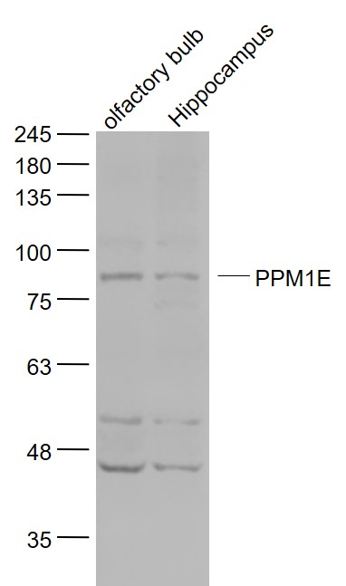 PPM1E Rabbit pAb(bs-21063R)-50