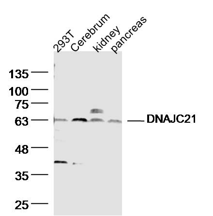 DNAJC21 Rabbit pAb(bs-14387R)-