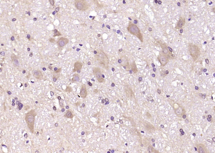 CCDC134 Rabbit pAb(bs-8079R)-5