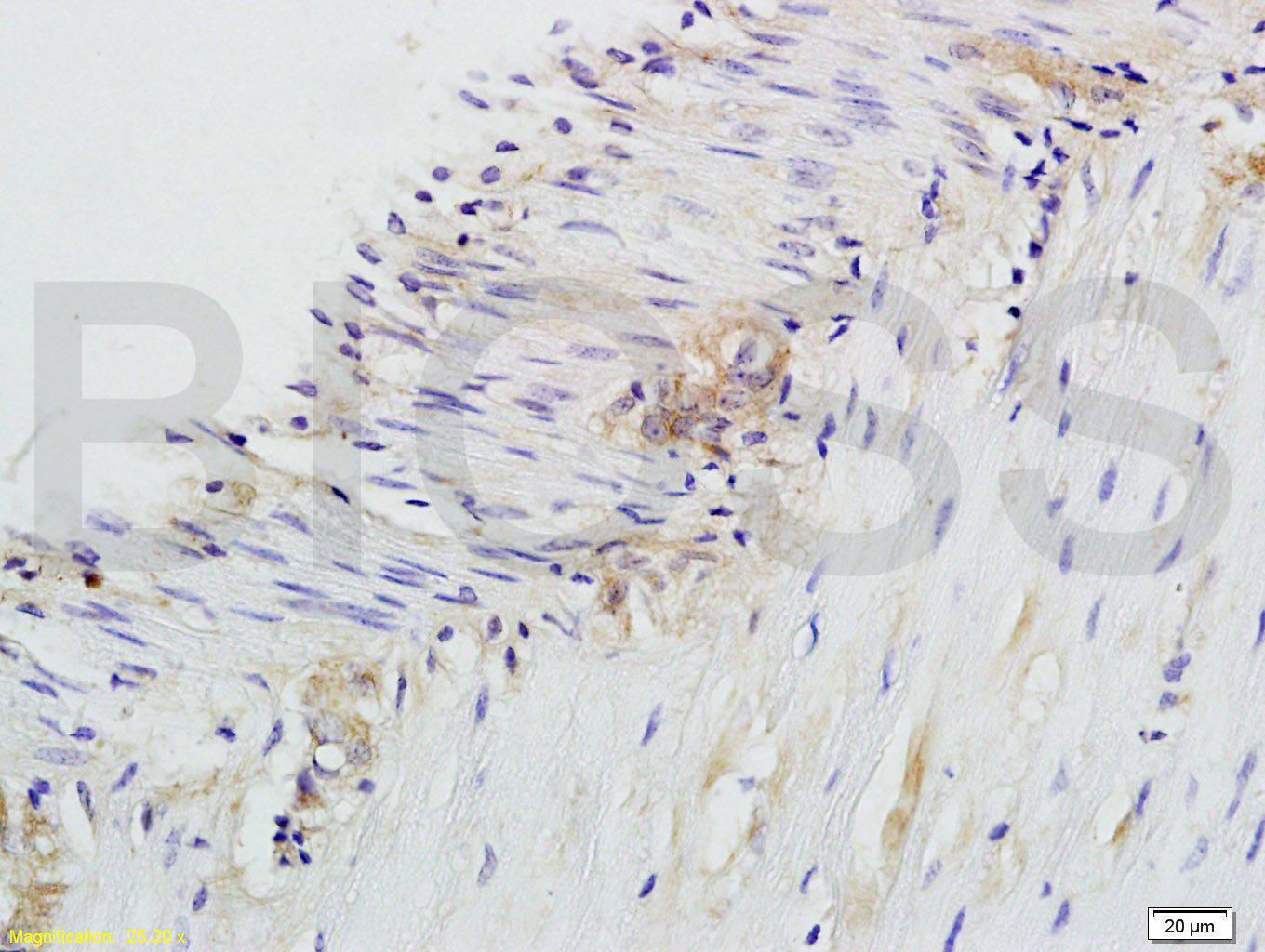 CD28 Rabbit pAb(bs-1297R)-50ul