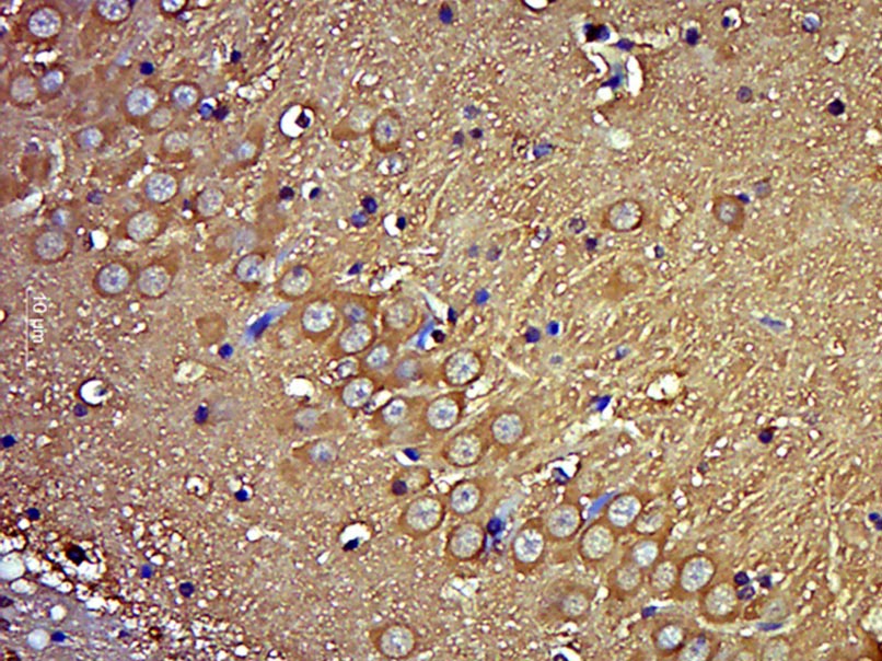 HYLS1 Rabbit pAb(bs-18114R)-50