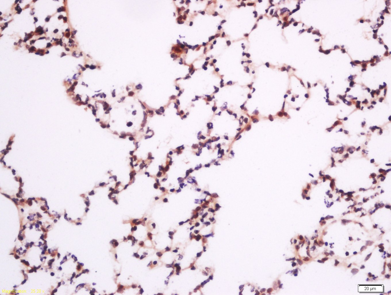 phospho-PLCG1 (Tyr783) Rabbit 