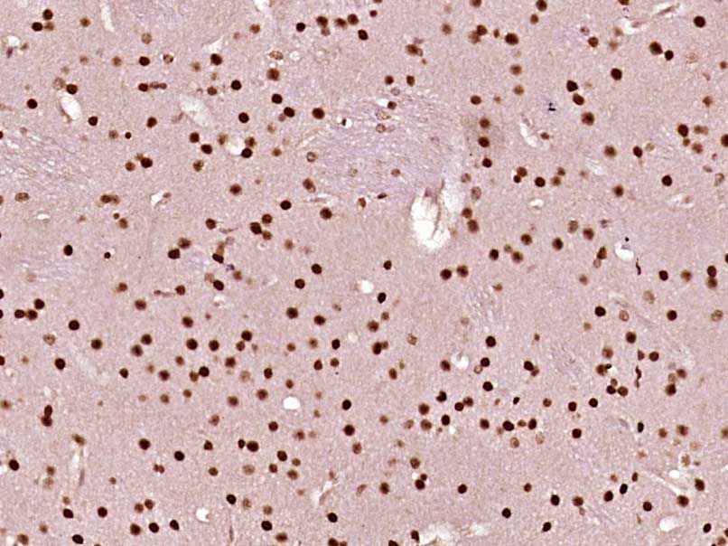 RSK3 Rabbit pAb(bs-3553R)-50ul