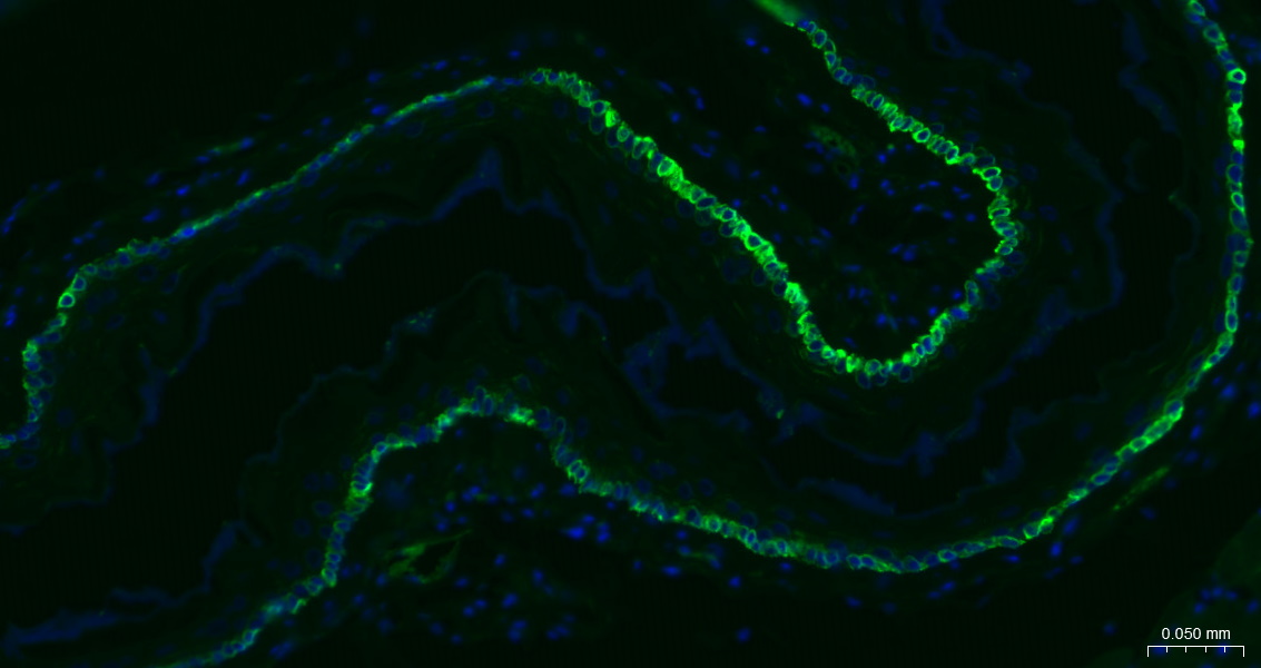 Cytokeratin 14 Recombinant Rab