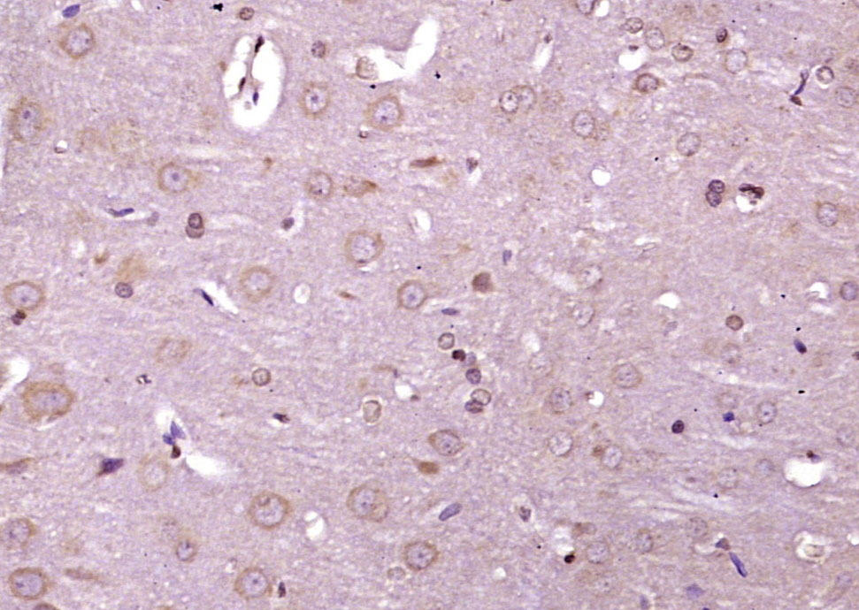 phospho-IRE1a (Ser 726) Rabbit