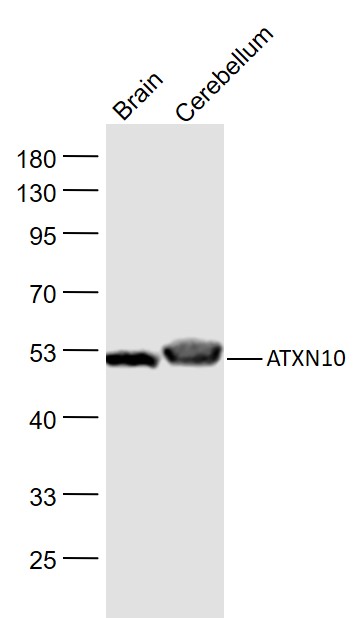 ATXN10 Rabbit pAb(bs-11806R)-5