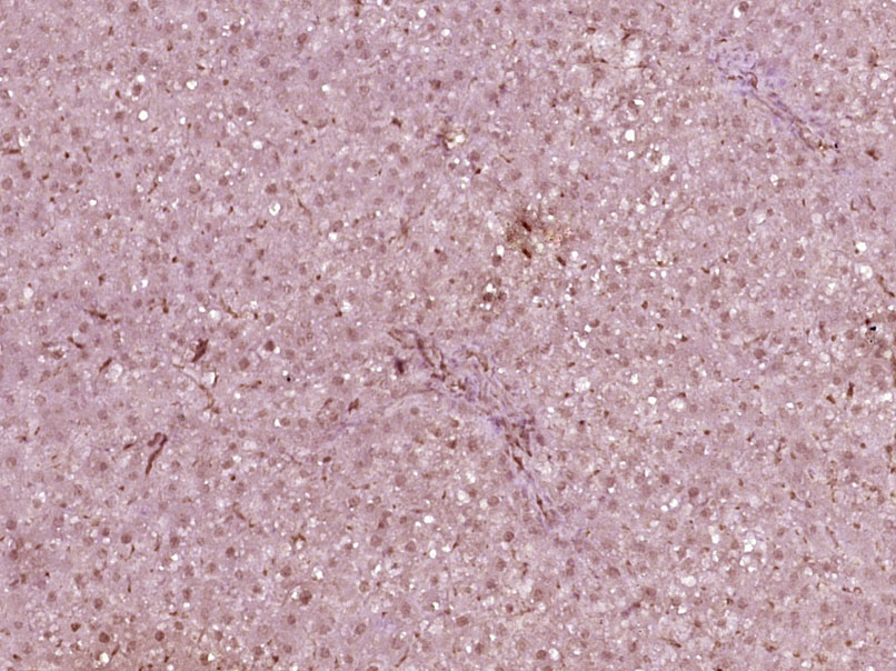 HNF1A Rabbit pAb(bs-1405R)-50u