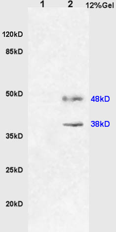 HO-2 Rabbit pAb(bs-1238R)-50ul